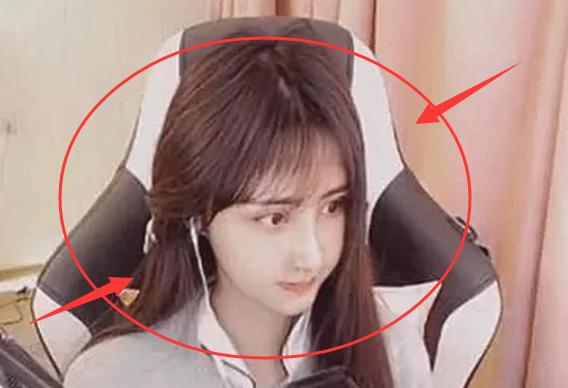 女主播“整容失败”案例？看LOL董月月的网红锥子脸：下巴都歪了